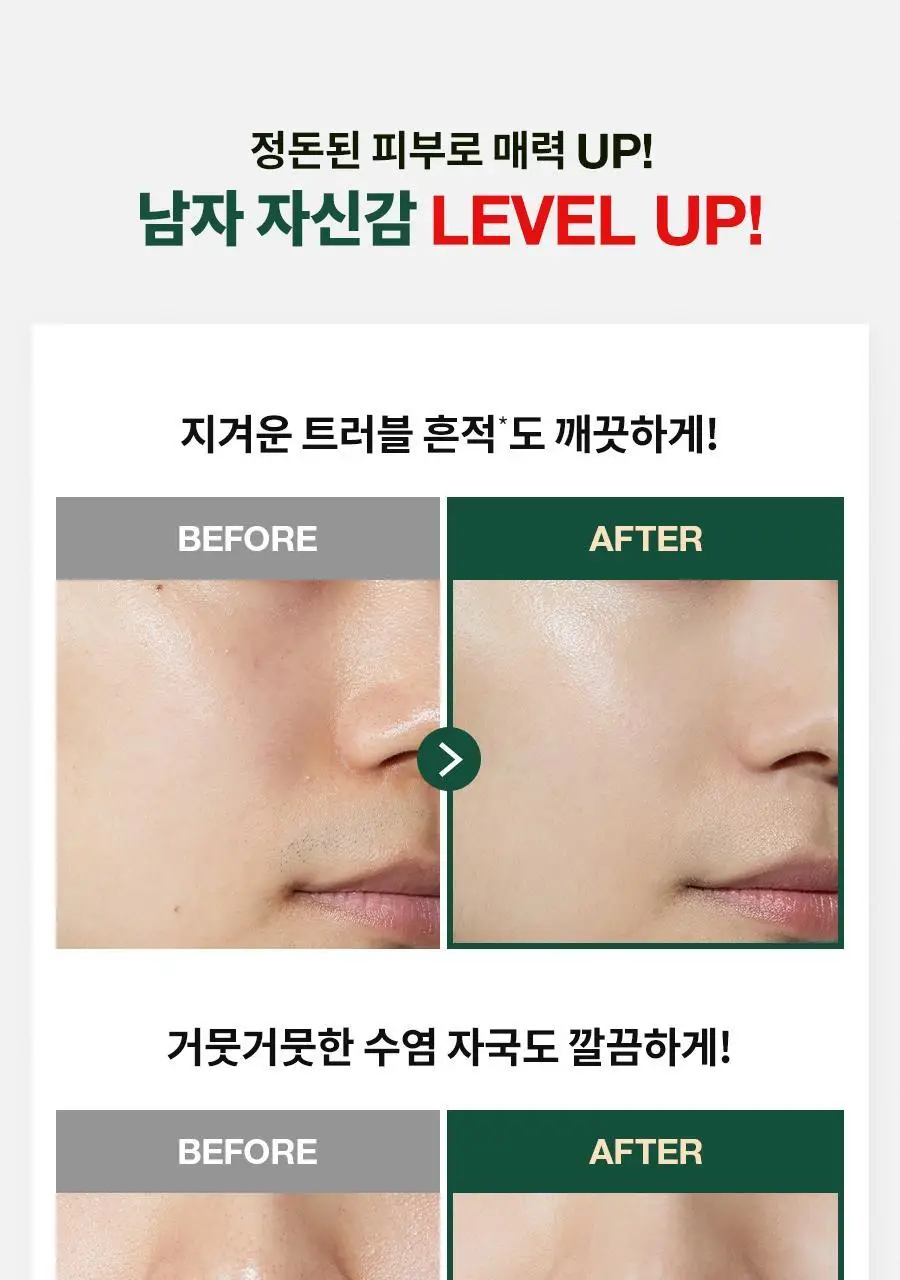 [선케어/반톤업] 닥터지 레드 블레미쉬 포 맨 올인원 톤 로션 50ml 기획 (+젠틀폼 30ml) 상세페이지 9